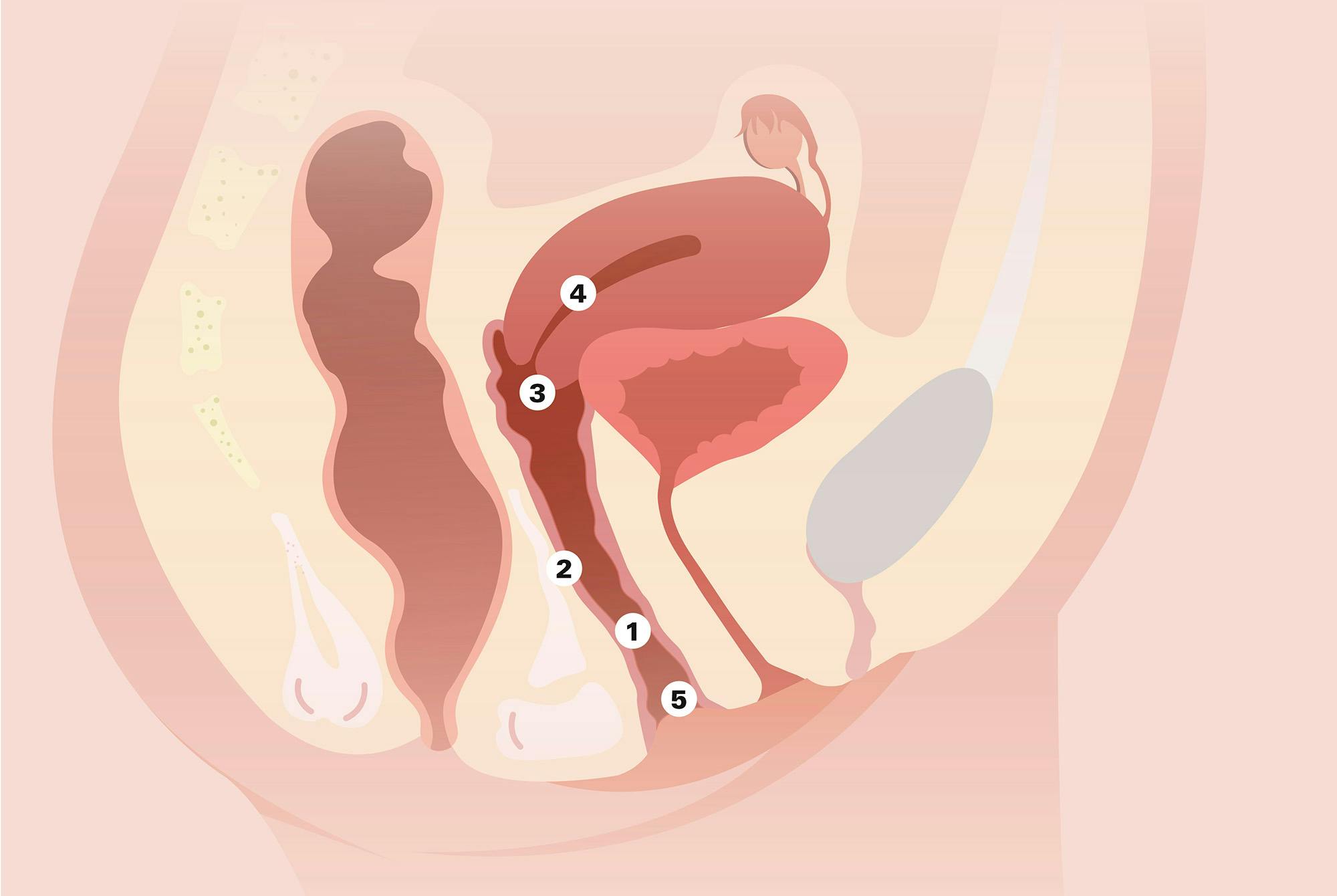 Tverrsnitt av en kvinnes bekken som en tegning