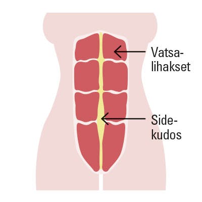 Piirros normaaleista vatsalihaksista