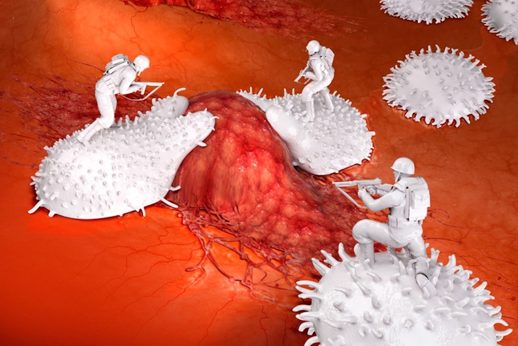 immunterapi