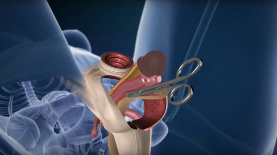 Butunlay jinni Yubka ostidagi ayollarning porno suratlari