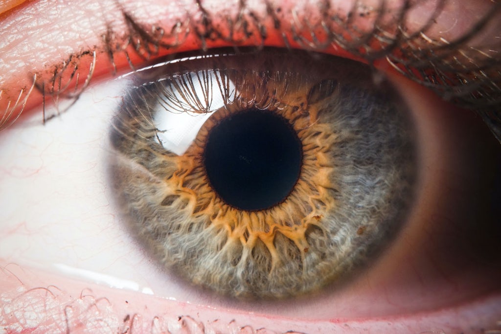 Verschillende kleuren ogen zijn te danken aan genen, letsel of ziekte