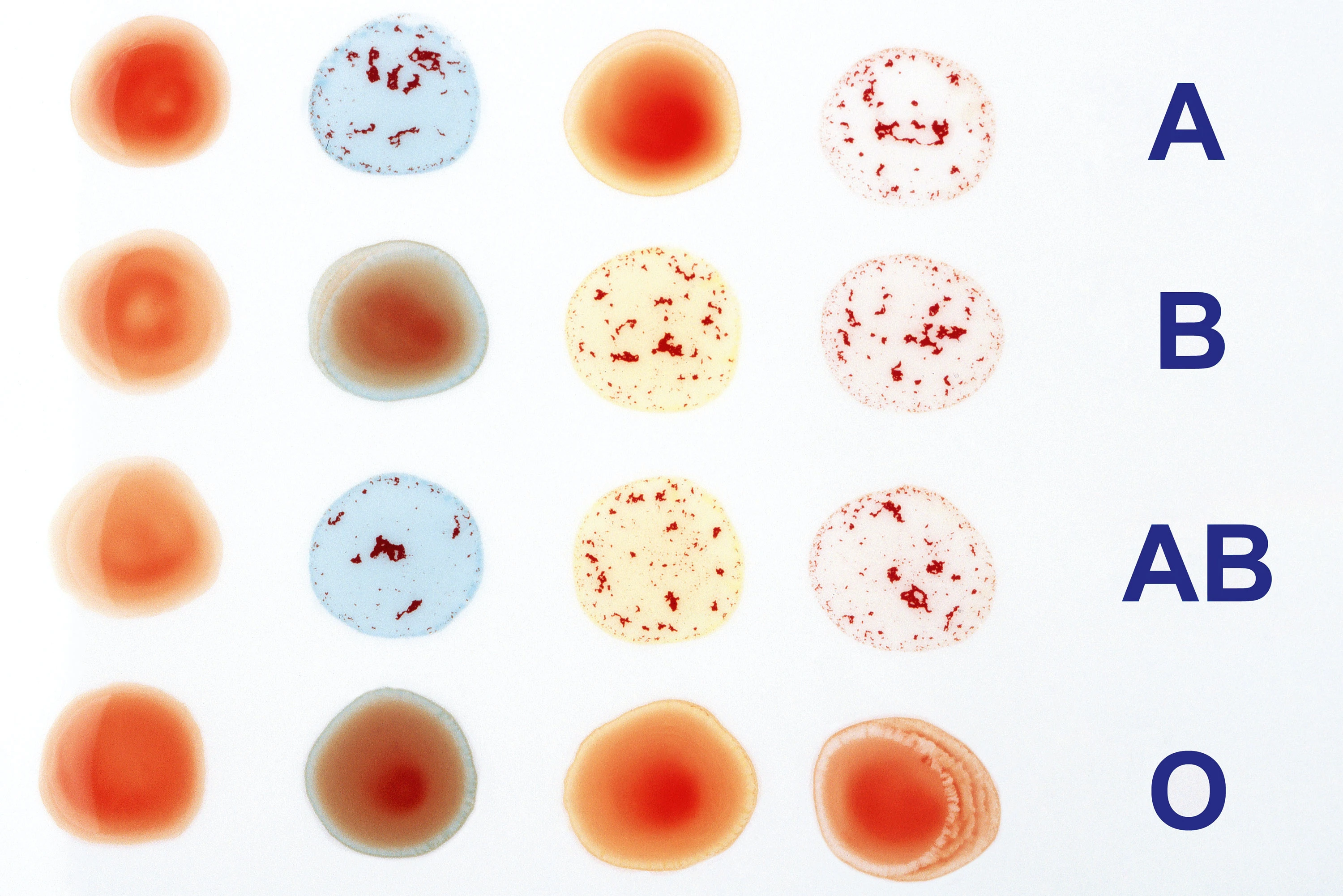 Bloedgroepen: Van wie stamt mijn bloedgroep? | wibnet.nl