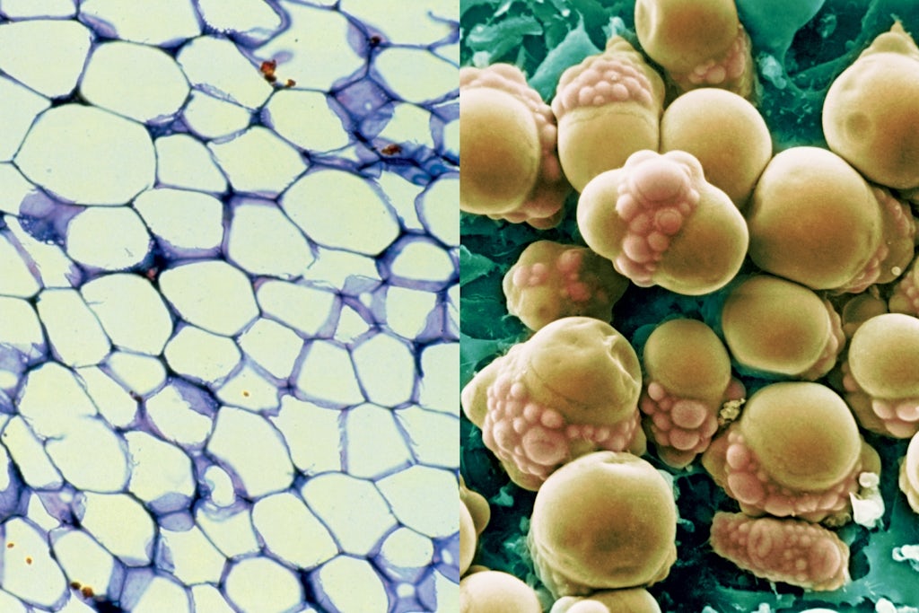 white and brown fat cells