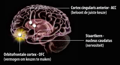 Obsessieve-compulsieve Stoornis - OCS | Wibnet.nl