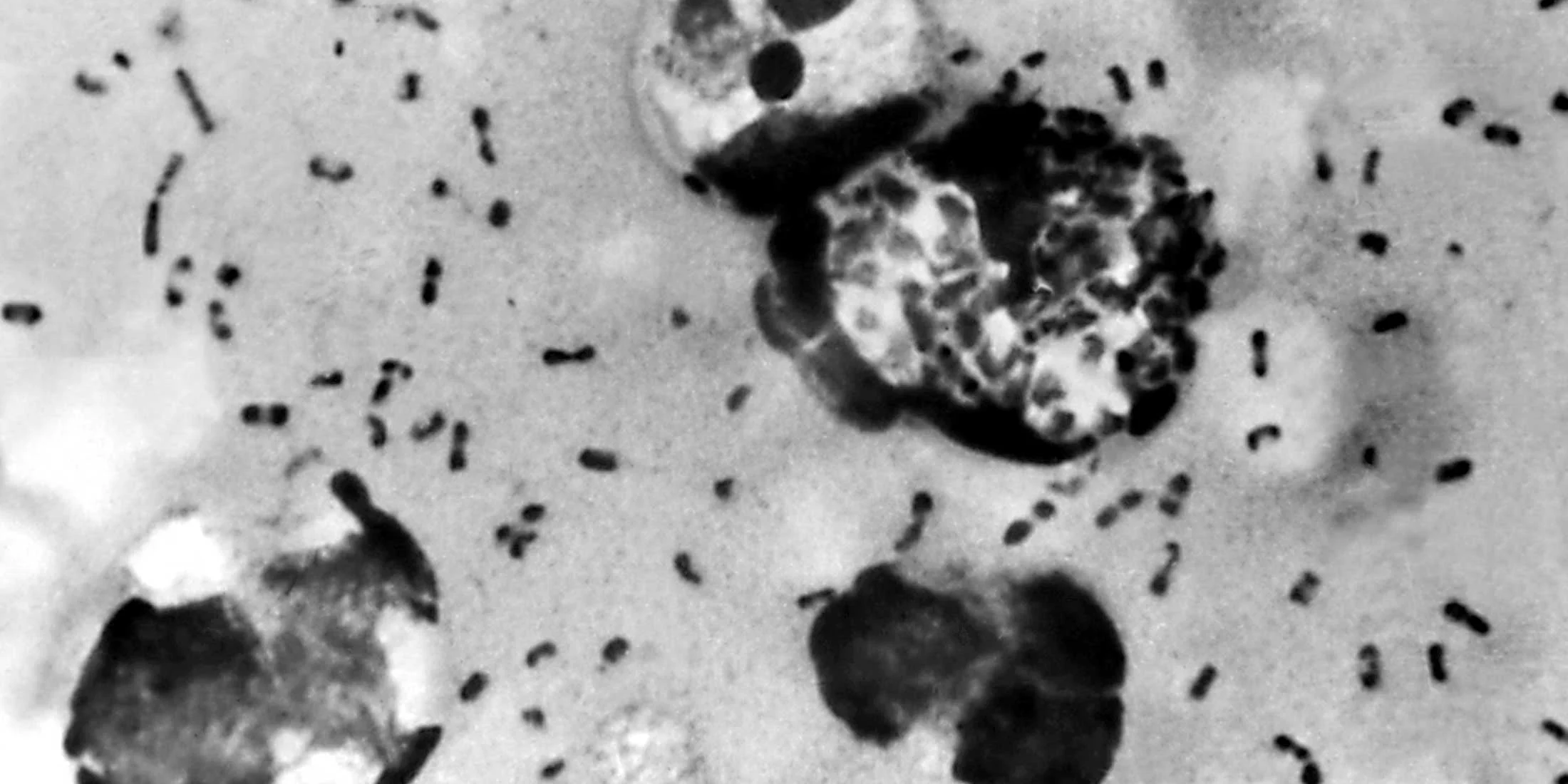 Pest Waar Begon De Zwarte Dood Wetenschap In Beeld Wibnet nl pest-waar-begon-de-zwarte-dood-wetenschap-in-beeld-wibnet-nl