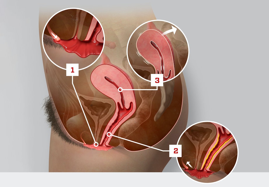 Shaxsiy arxivdan ogirlangan jinsiy aloqa porno video Soxta sperma pornosini onlayn tomosha qiling