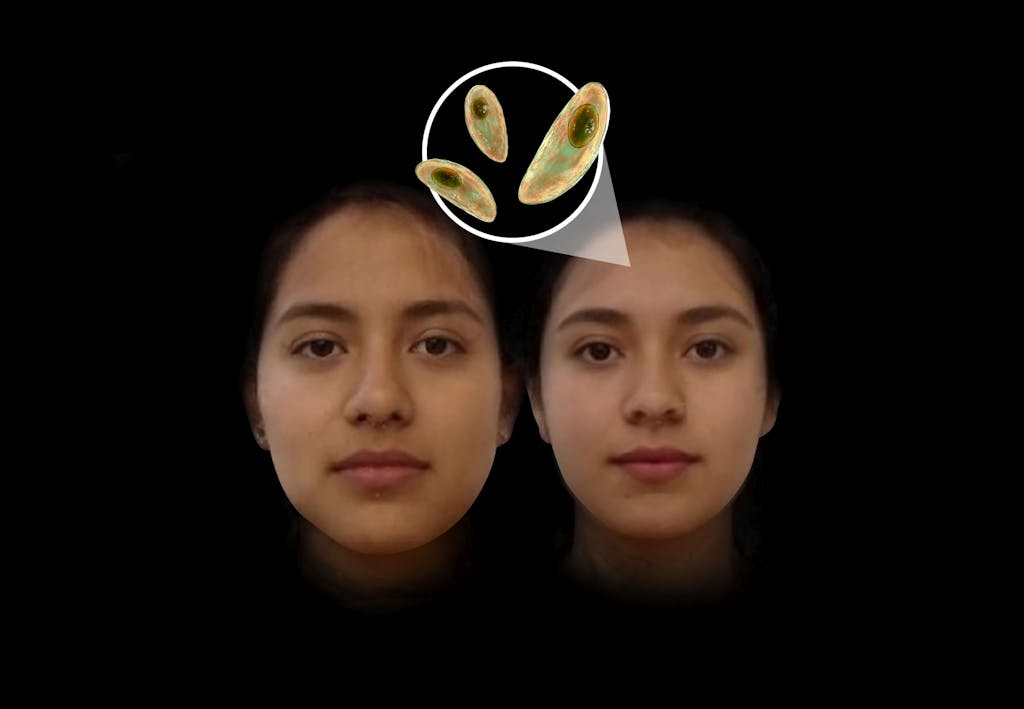 Parasit gör människor attraktiva Parasit gör människor attraktiva