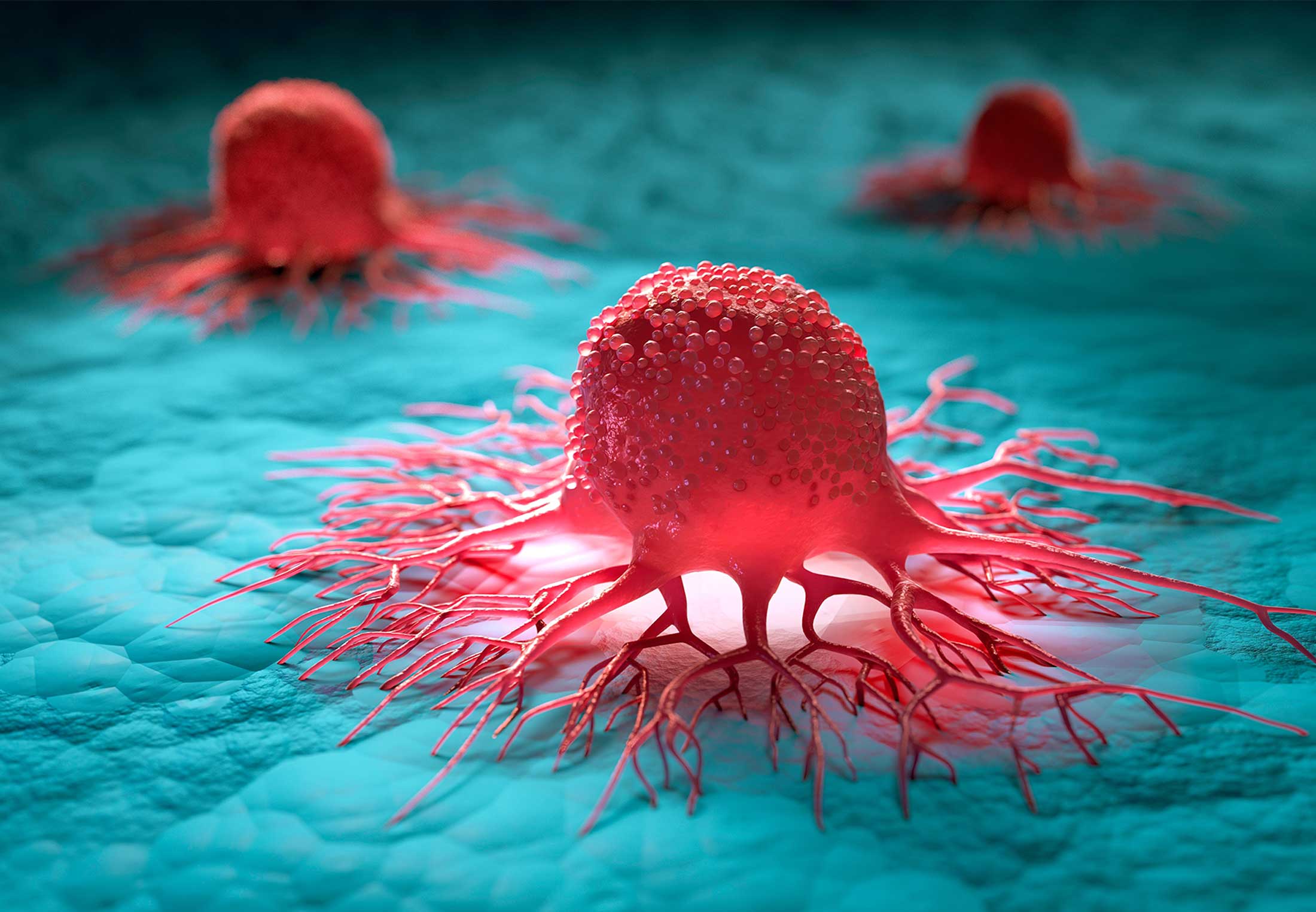Cancer cell
