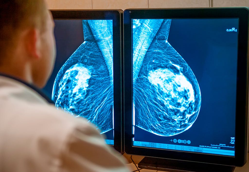 Man tittar på mammografi.