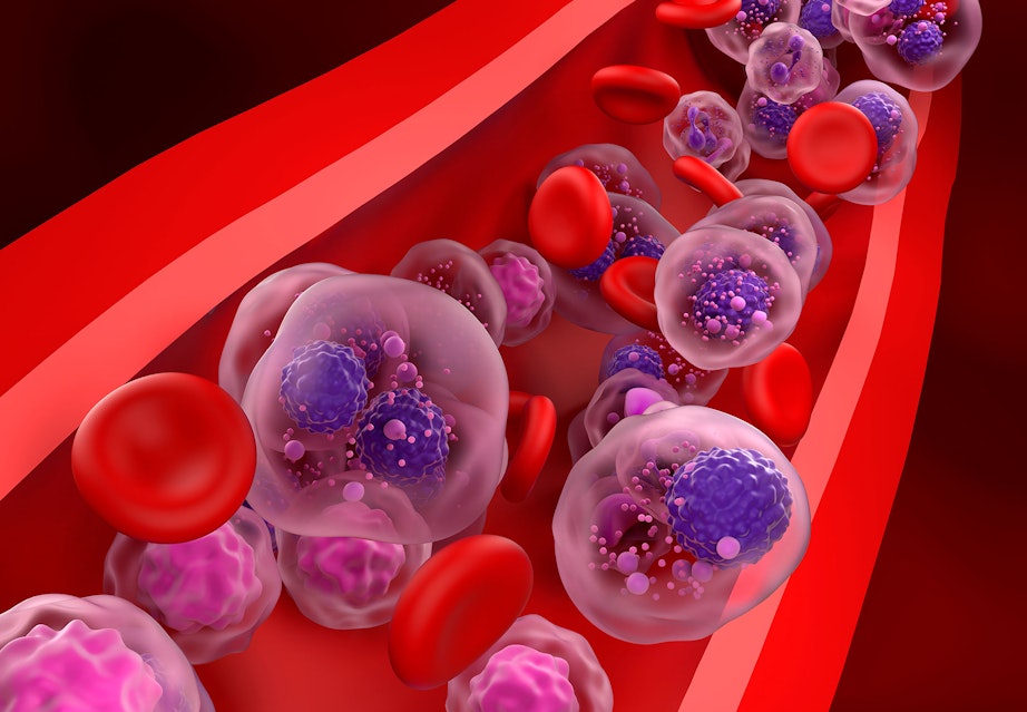 Study Artificial Intelligence Can Spot Precancerous Conditions study-artificial-intelligence-can-spot-precancerous-conditions