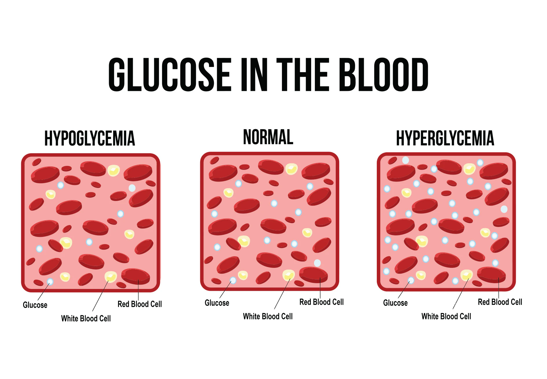 Wat is glucose en hoe meet je bloedglucose? | wibnet.nl