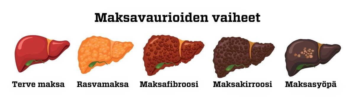 Maksa – näin se toimii | tieku.fi