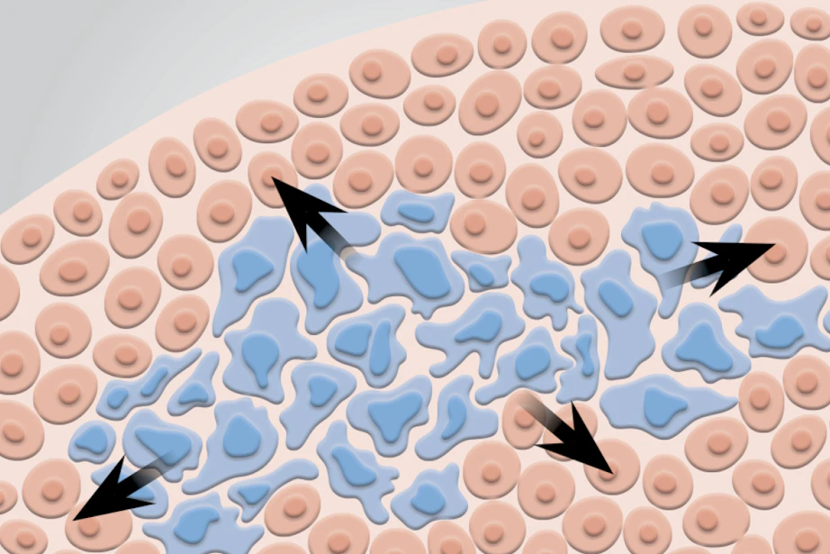 Scientists find a trick to starve cancer cells to death ...