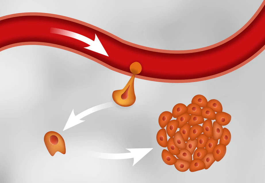 Cancer sprids på natten | illvet.se