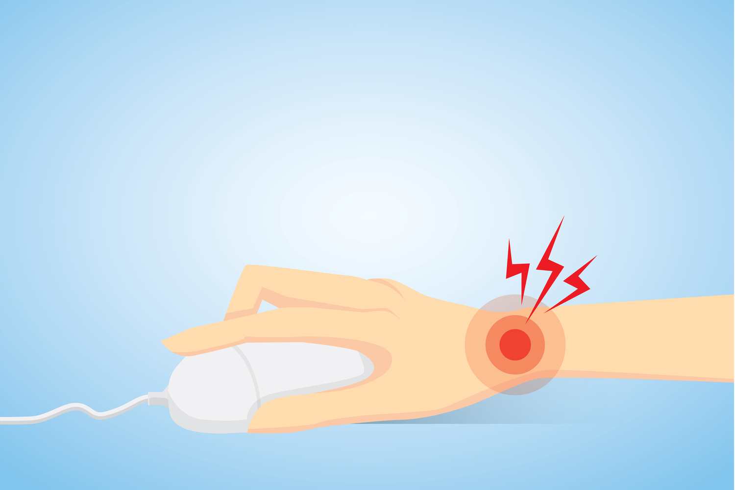 Museskader og musearm er smerter i armen. Kan udvikle sig til karpaltunnelsyndrom.