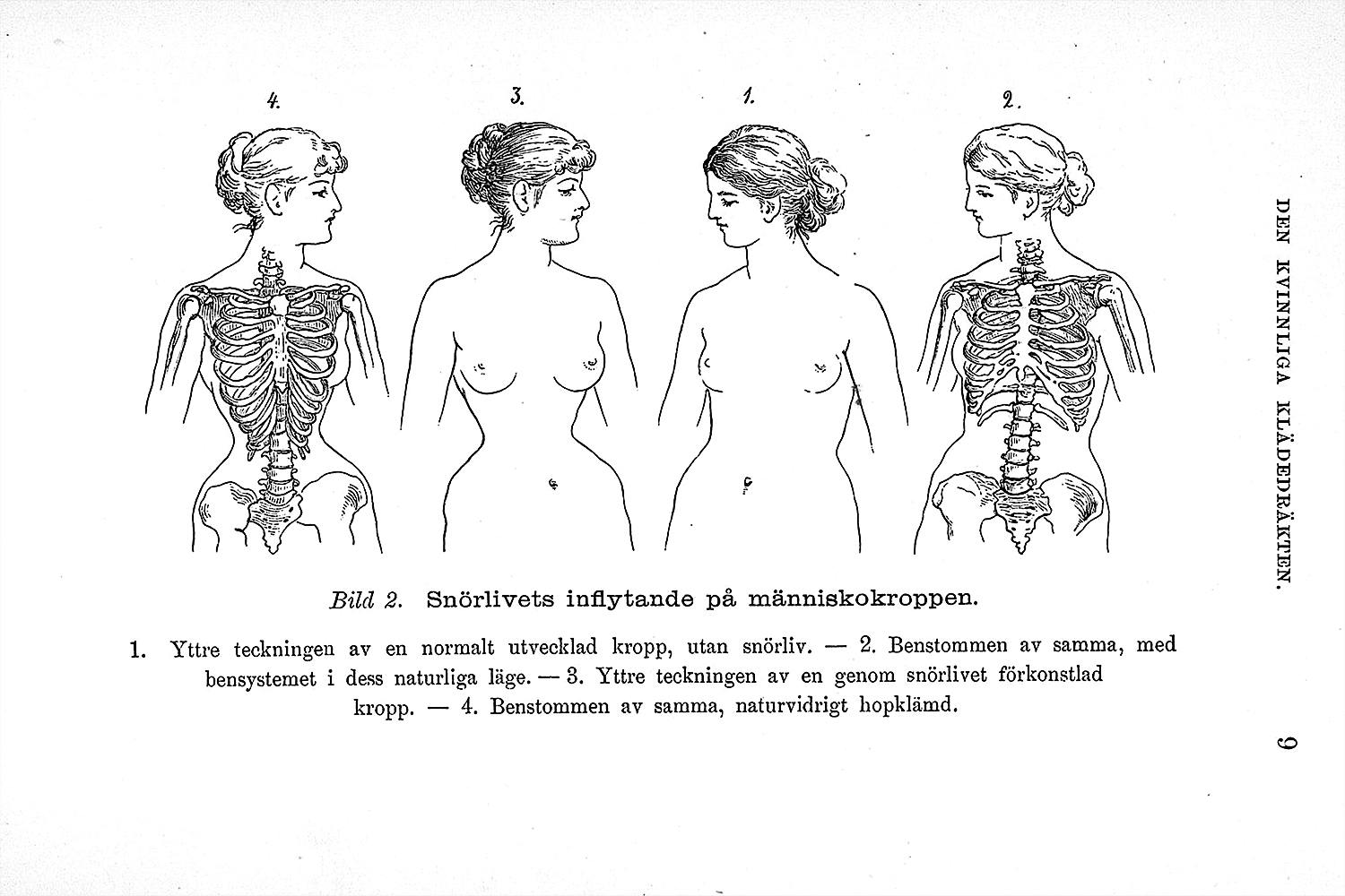 Karolina Widerström – Sveriges första kvinnliga läkare.