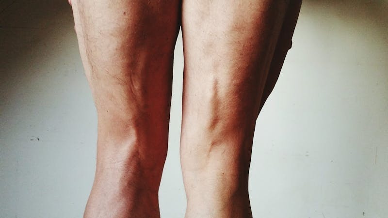 Tips til å bli kvitt vann i kroppen