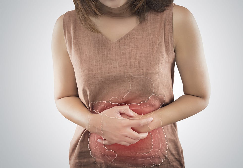Inflammatorisk tarmsykdom