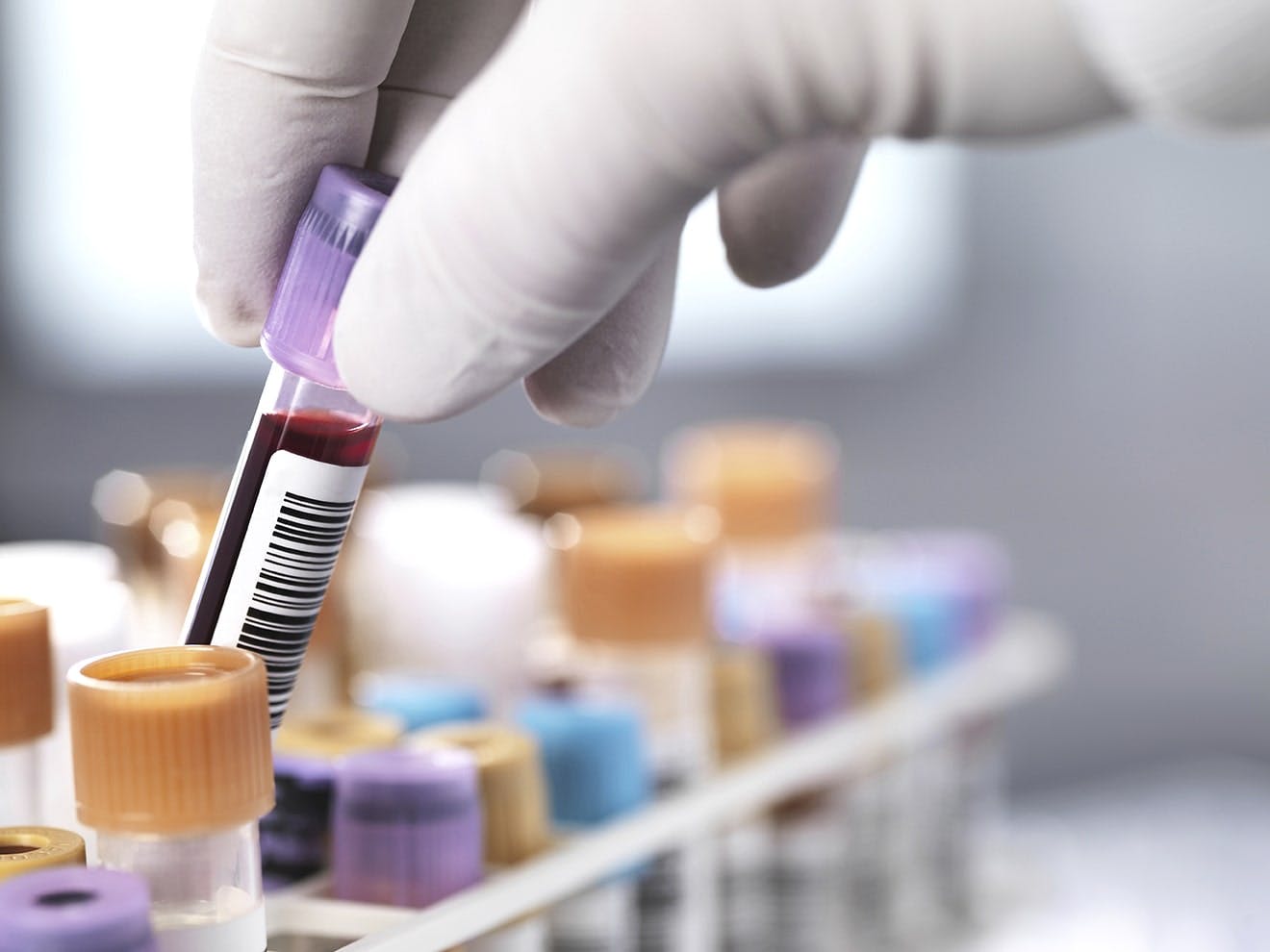 blodproeve overgangalder menopause min Hvordan ved du om du er i overgangsalderen?