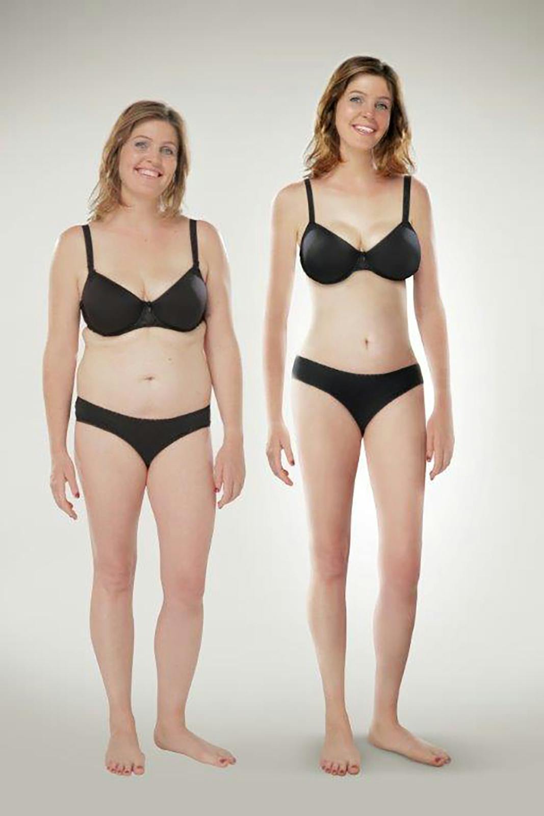 Retusjering kropp Sanitetskvinnene