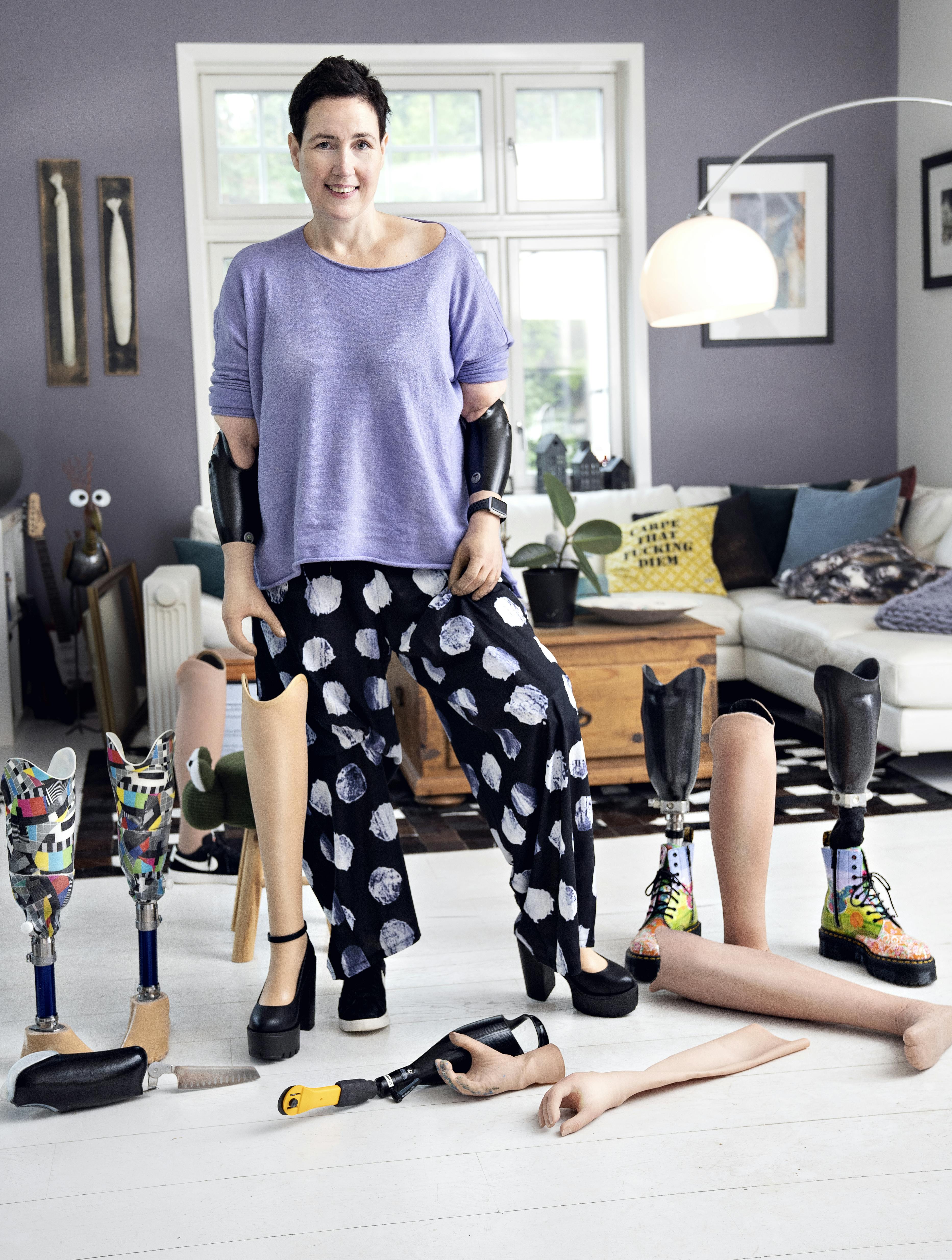 Gry Hege Henriksen, proteser